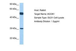 ACCN1 Rabbit anti-Human, Polyclonal, Novus Biologicals 0.1ml; Unconjugated:Antibodies,